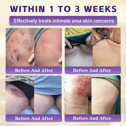 WindolixĀ® Biotin 10-in-1 Skin Restoration Cream