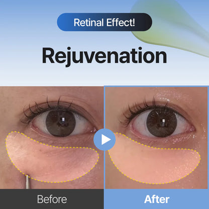 MEDITHERAPY Retinal Skin Booster Serum | Retinaldehyde, Niacinamide Anti-Aging Serum - K-Beauty Facial Serum for Fine Lines, Firming & Radiance | Hydrating Face Serum All Skin Types