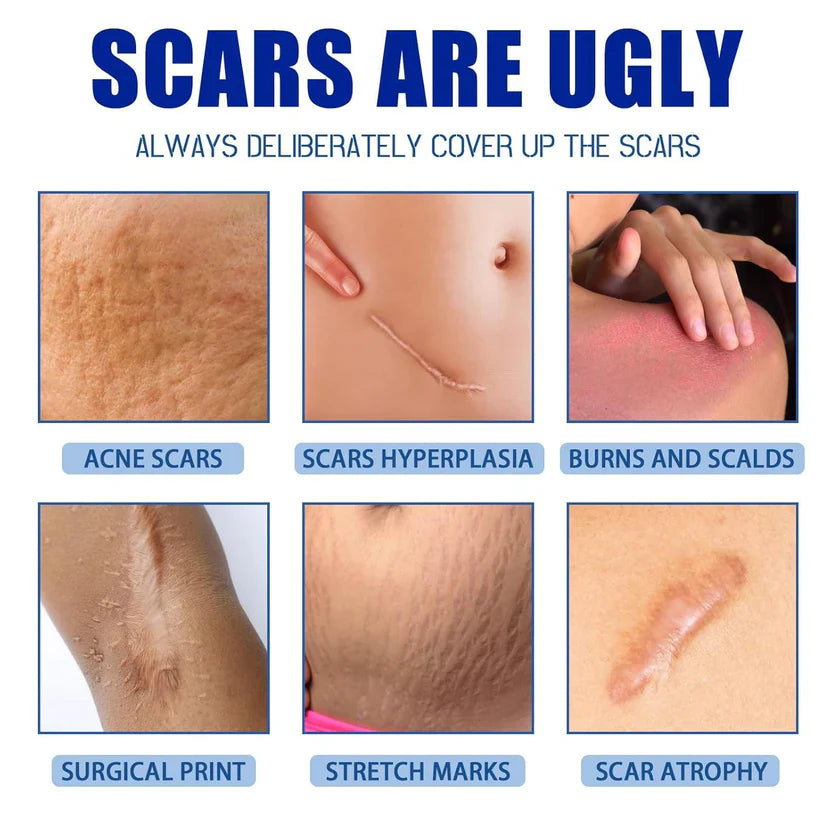 🩹 Alcuras Medical Grade Silicone Scar Cream – Smooth Scars Fast!
