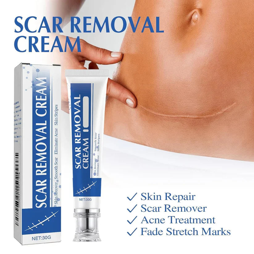 🩹 Alcuras Medical Grade Silicone Scar Cream – Smooth Scars Fast!