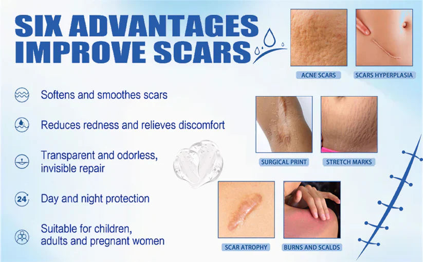 🩹 Alcuras Medical Grade Silicone Scar Cream – Smooth Scars Fast!