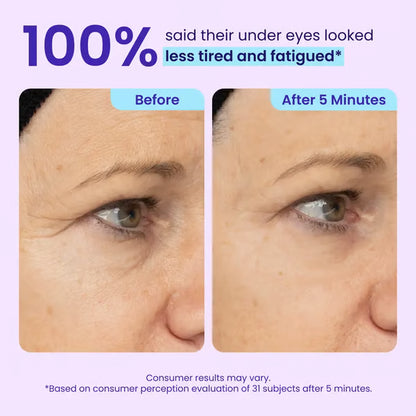 🔥2026 NEW! Instant Firming Eye Gel – Lift, Smooth & De-Puff in Minutes