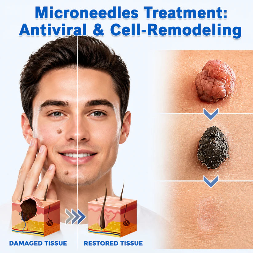 ✨ShapeOil®2-in-1 Microneedle & Hydrocolloid Patch🍀| Removes Raised Moles, Acne, Flat Warts & Skin Tags | Helps Improve Wrinkles, Scars & Blemishes | Invisible Patches for Face & Body