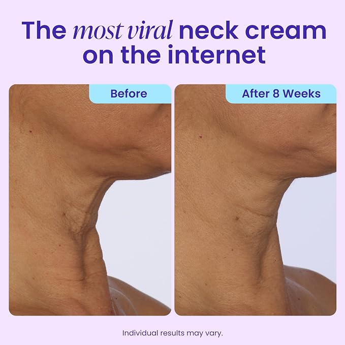 ✨ CAFFEINE MATRIXBUST FIRMING NECK CREAM