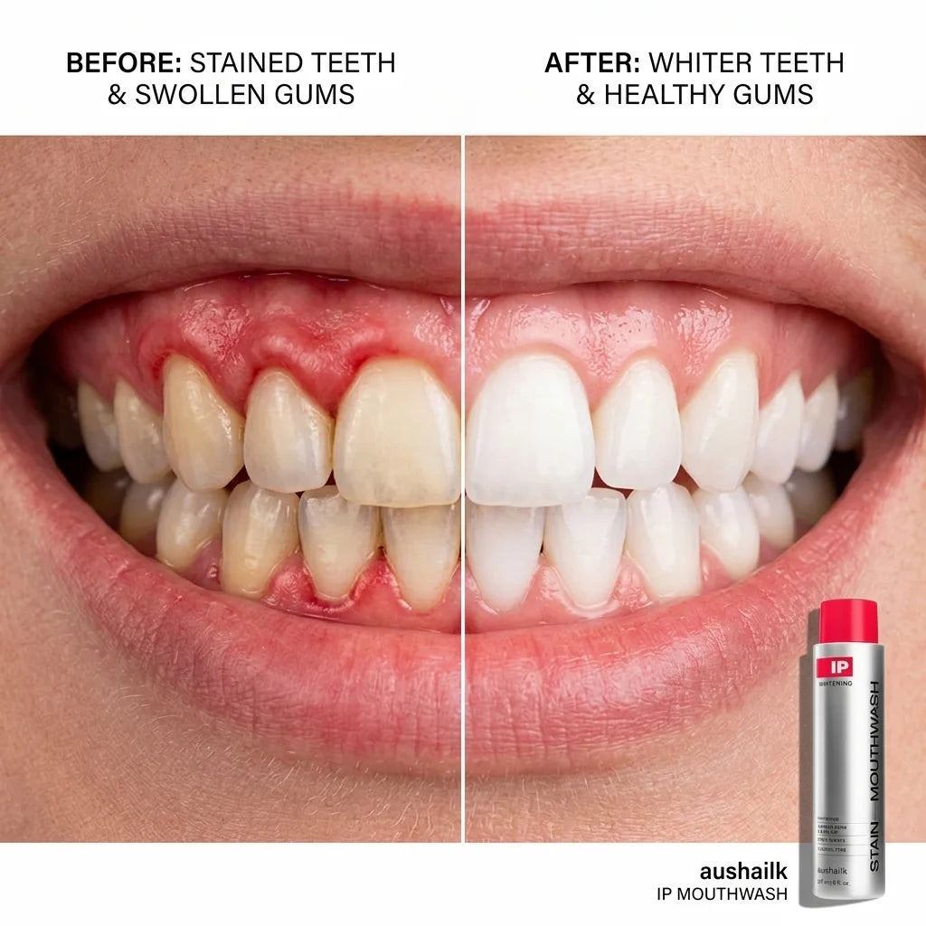 😁 Teeth whitening, gum swelling and pain relief, gum repair, halitosis treatment, mouthwash for removing foreign objects, whitening mouthwash