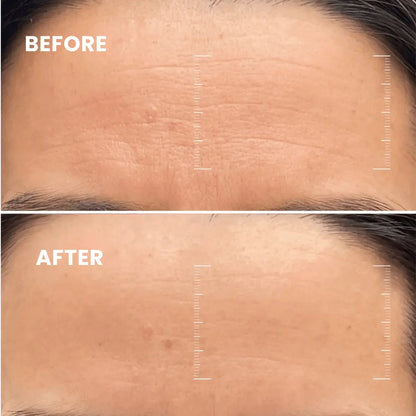 CollagenMask Collagen-Boosting Night Mask | Visibly younger skin in just 7 days!