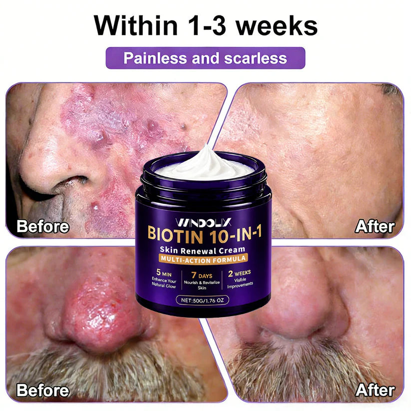 Windolix® Biotin 10-in-1 Skin Restoration Cream