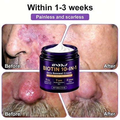 Windolix® Biotin 10-in-1 Skin Restoration Cream