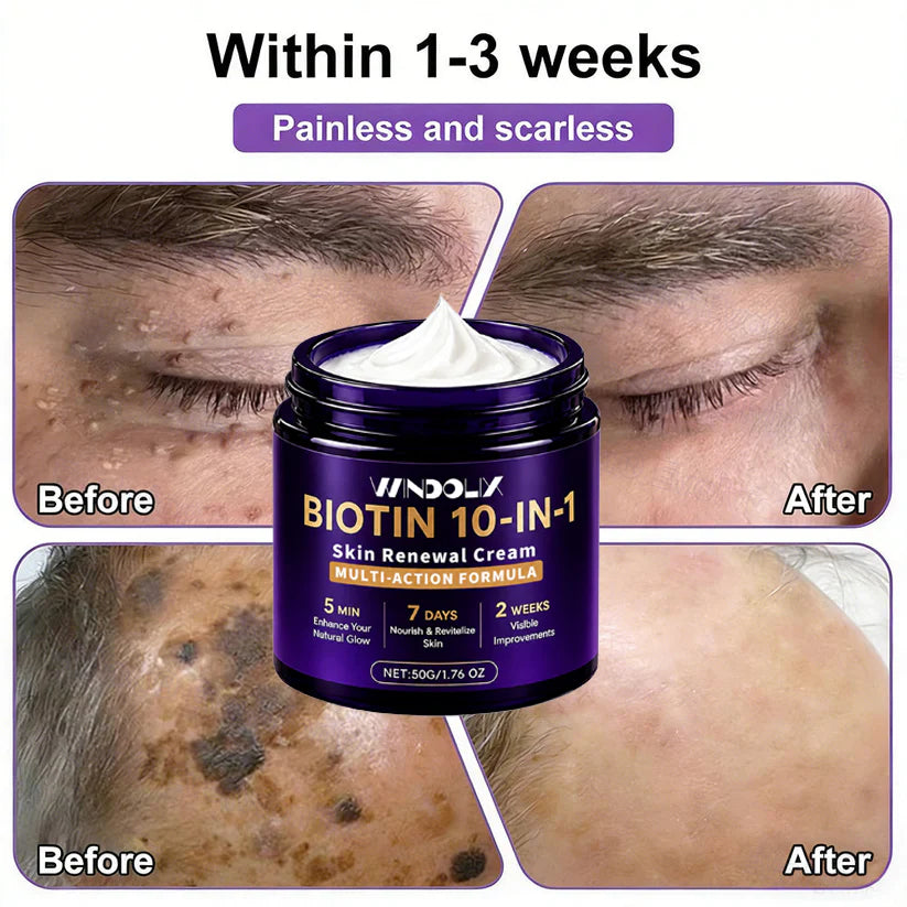 Windolix® Biotin 10-in-1 Skin Restoration Cream