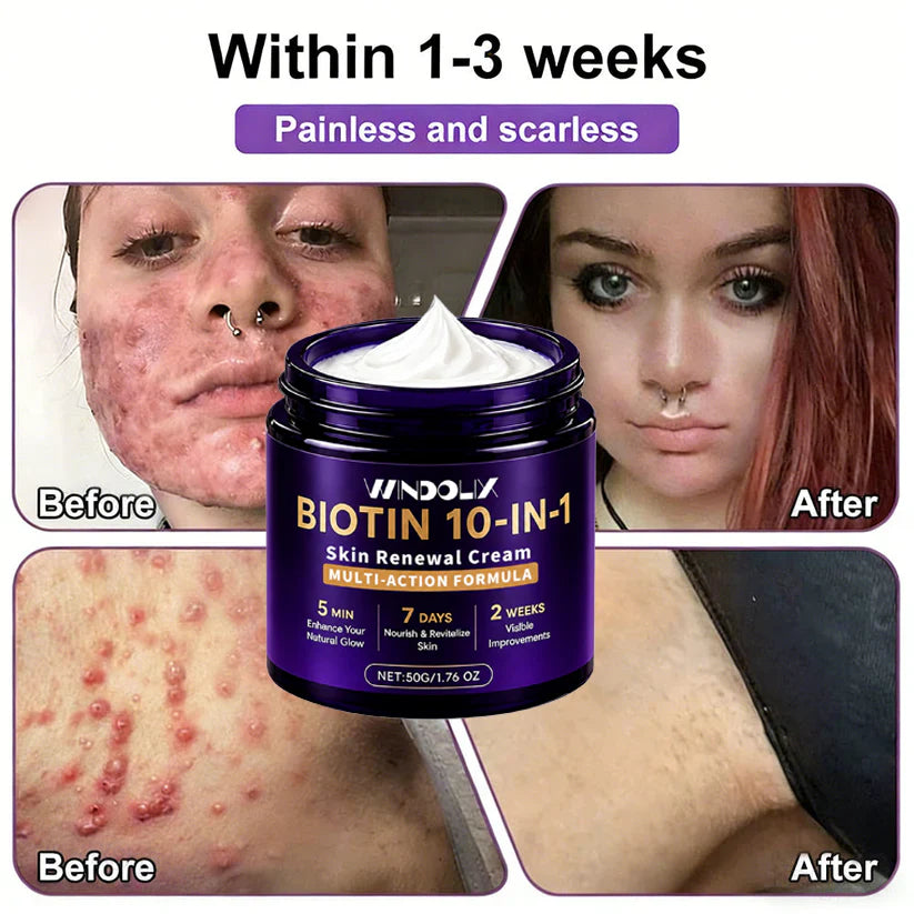 Windolix® Biotin 10-in-1 Skin Restoration Cream