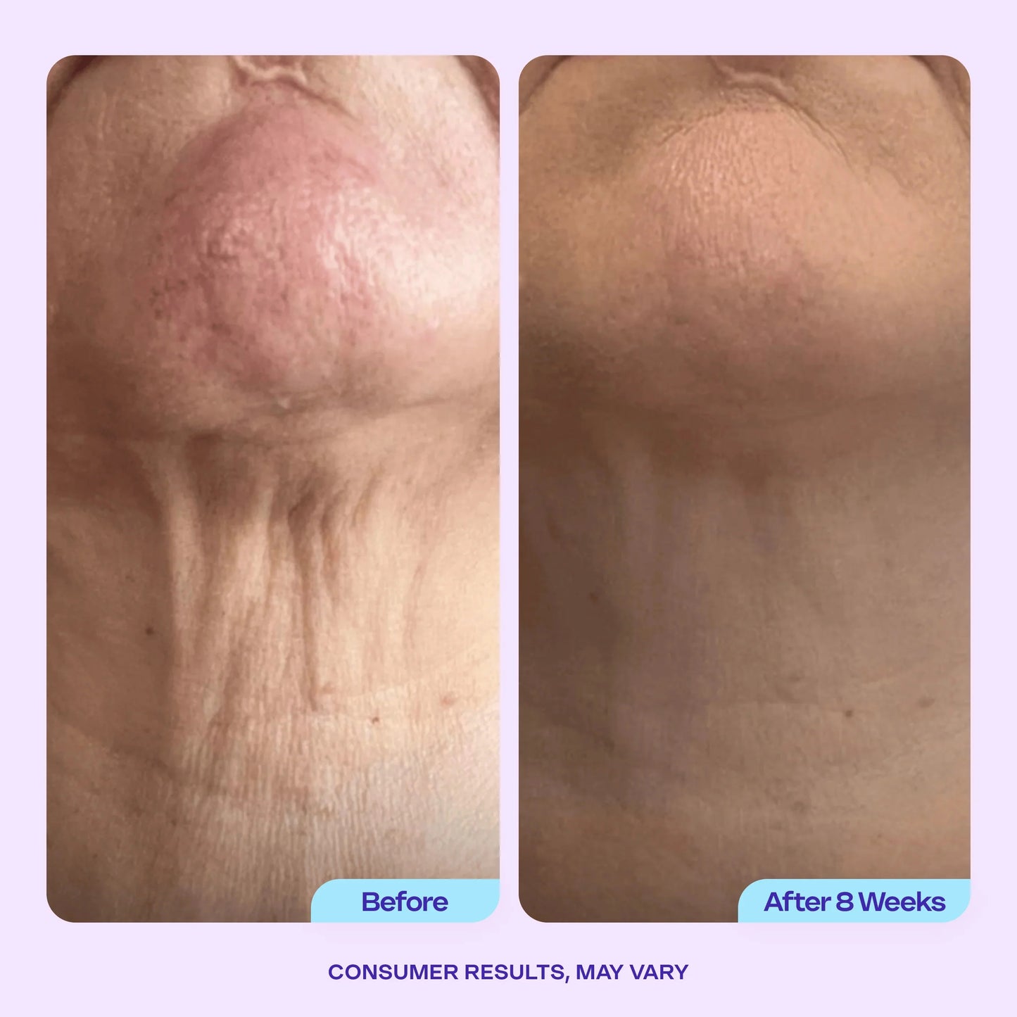 ✨ CAFFEINE MATRIXBUST FIRMING NECK CREAM