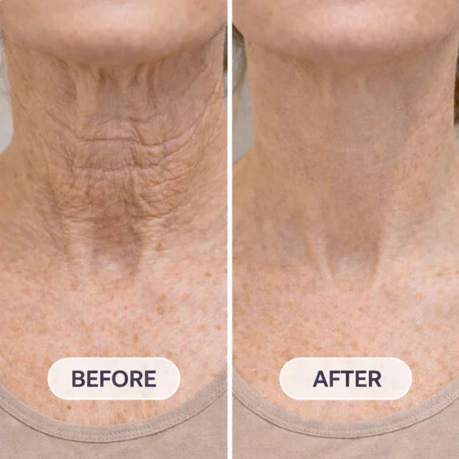 ✨ MAGIC COLLAGEN & FULLERENE NECK CREAM Lift. Tighten. Sculpt. Reverse the Look of Neck Aging in Days 💎