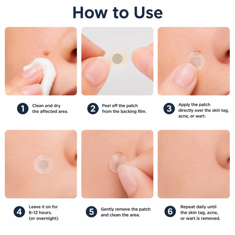✨ShapeOil®2-in-1 Microneedle & Hydrocolloid Patch🍀| Removes Raised Moles, Acne, Flat Warts & Skin Tags | Helps Improve Wrinkles, Scars & Blemishes | Invisible Patches for Face & Body