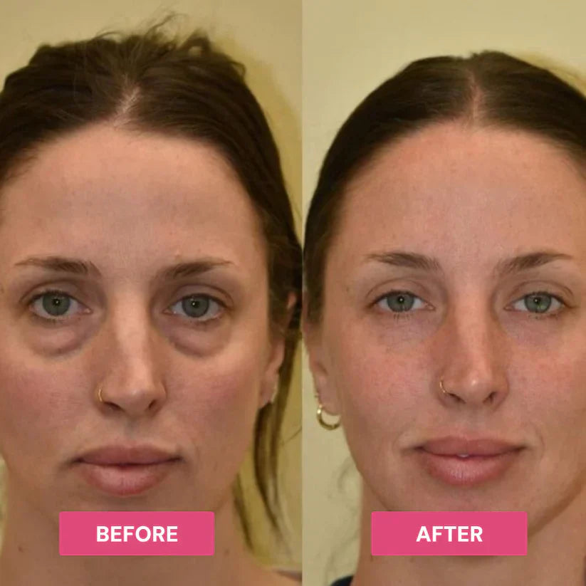 Revive Tired Eyes – Hydrating & Anti-Wrinkle Eye Balm